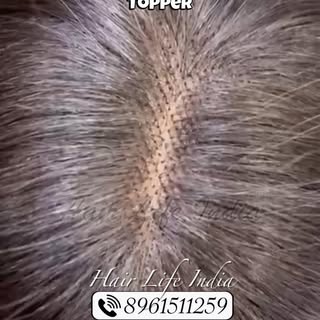 Confidence begins with the right hair. ✨

Thin hair, hair loss, or low volume shouldn’t stop you fro