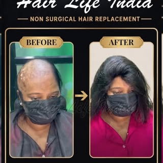 ✨ Confidence begins with the right transformation.

See the incredible Before ➝ After result with ou
