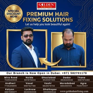 Hair loss around the front hairline, temples, or crown could be an early sign of Male Pattern Baldne