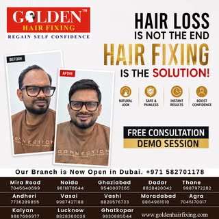 Hair loss around the front hairline, temples, or crown could be an early sign of Male Pattern Baldne