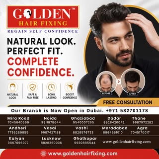 Hair loss around the front hairline, temples, or crown could be an early sign of Male Pattern Baldne