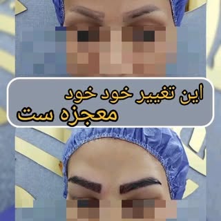 کاور کامل تتوی ابرو یعنی این☝️☝️☝️

با خیال راحت میتونی یک تغییر اساسی و دائم رو بخودت هدیه بدی و بر