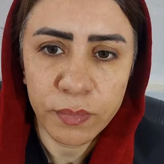 مزایای تزریق پلاسما ژل به صورت

✅ عدم ایجاد آلرژی
✅ کاملا طبیعی
✅ تاثیر گذاری فوق العاده عالی
✅ هزین