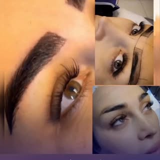 کاشت ابرو به روش FIT (میکروکاشت - بدون جراحی)

کاشت ابرو ، راهی برای زیبایی طبیعی و اعتماد به نفس بی