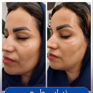 پوستی که خودش رو ترمیم می‌کنه…

بدون فیلتر، بدون مواد شیمیایی سنگین…
فقط با قدرت بدن خودت ✨

در این 