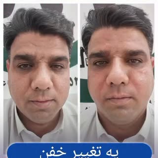 بخش زیادی از مراجعین ما جزو کیس‌های خصوصی هستند و به احترام حریم شخصی‌شون امکان انتشار تصاویر قبل و 
