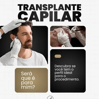 A dúvida é comum: “Será que o transplante capilar é pra mim?”
E a resposta depende de alguns pontos 