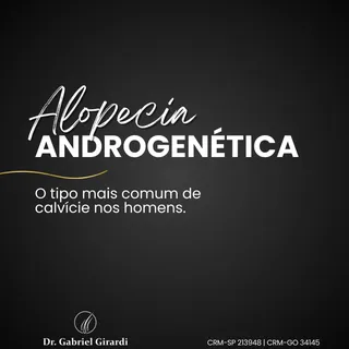 A Alopecia Androgenética é a principal causa de queda de cabelo nos homens.
Ela tem origem genética 