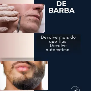 A barba vai além da estética.
Ela representa identidade, confiança e autoestima.

O transplante de b