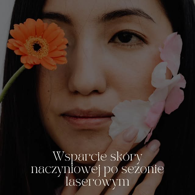 Wsparcie skóry naczyniowej po sezonie laserowym 

Sezon laserowy to intensywny czas dla skóry naczyn