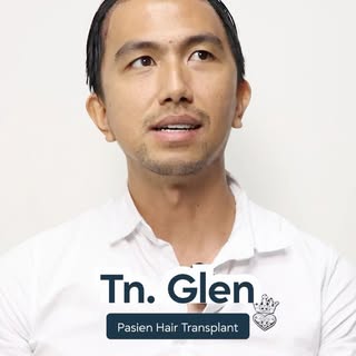 Testimoni kami dari Tn. Glen yang telah melakukan hair transplant😍

Sobat jaksel, dapatkan promo ha