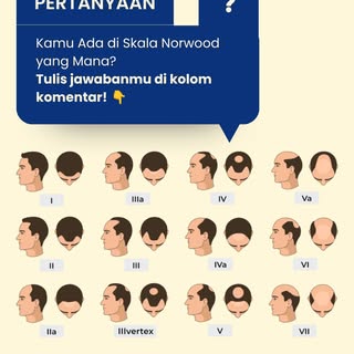 Kerontokan rambutmu sudah sampai tahap berapa? 🤔

Skala Norwood adalah klasifikasi yang digunakan u