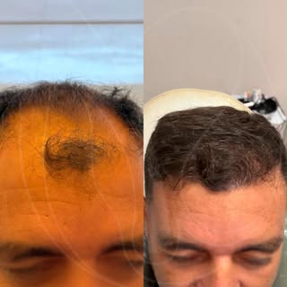 Quando falamos em saúde capilar, não estamos falando apenas de cabelos. Estamos falando de confiança