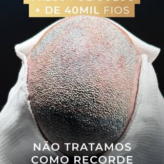 O que em muitos lugares, tratam como recorde, nós tratamos como algo normal. Na Artisti, essa é noss