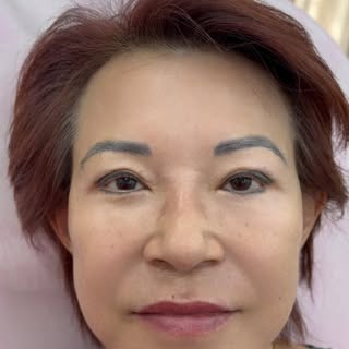 Entregando beleza e autoestima ✨
Toxina Botulínica