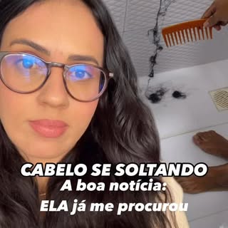 ✔️O cabelo dela tá se desprendendo com facilidade…
Isso não é normal — é eflúvio telógeno agudo.
A b