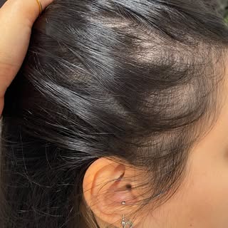 A falha capilar vai muito além da estética. Ela atinge a autoestima, a confiança e a forma como a mu