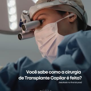 Você já se perguntou como acontece a nossa cirurgia de Transplante Capilar?

Neste carrossel, abrimo