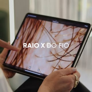 Bem-vindos ao Raio X do Fio 🔬

Nosso novo quadro dedicado à saúde capilar, onde esclarecemos SUAS d