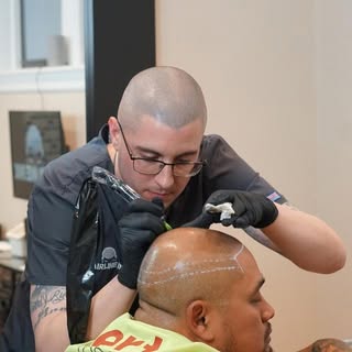 Scalp Micropigmentation is a procedure that injects custom ink into the scalp to give the appearance