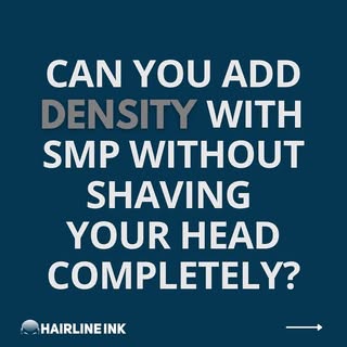Clients often ask us if they can receive SMP to add density to their existing hairline without needi