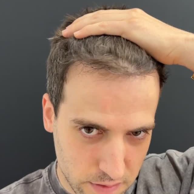 Este antes y después es una auténtica locura 🤯
El cambio es brutal 💥 Visible 👀 y 100% real ✅
Un i