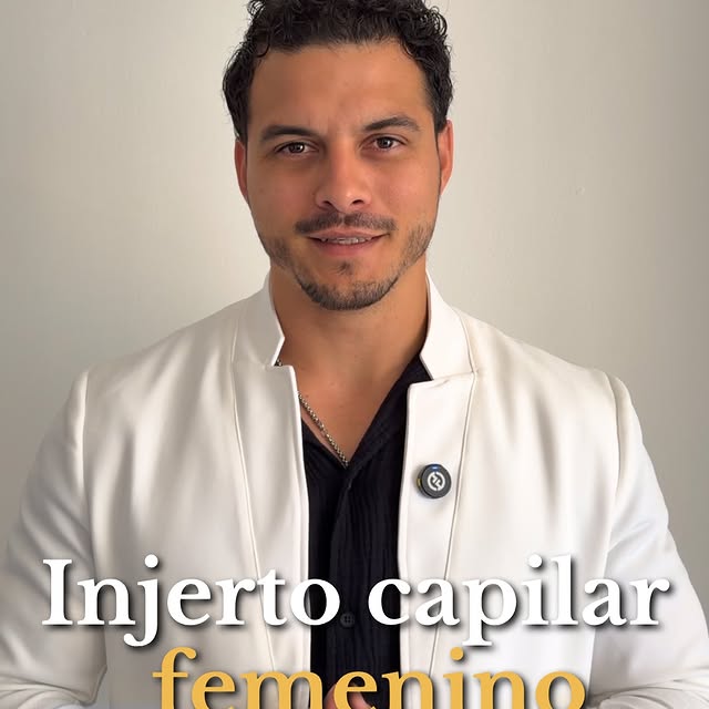 El injerto capilar femenino ha evolucionado mucho en los últimos años y cada caso se estudia de form