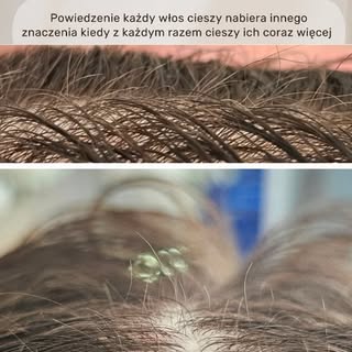 Każdy włos ma znaczenie. Dosłownie. 🤍

W kuracji trychologicznej moment, w którym zaczynają pojawia