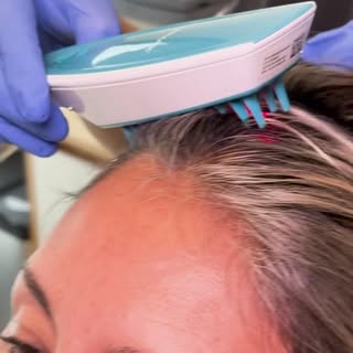 ¿Te preocupa la caída del pelo?
No esperes más. En Ya Pelo te ofrecemos una consulta gratuita con un