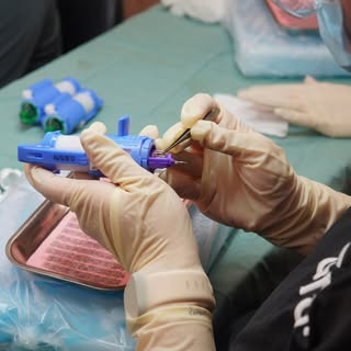 The tool that places each graft.

A multi graft implanter is loaded one follicle at a time. Each gra