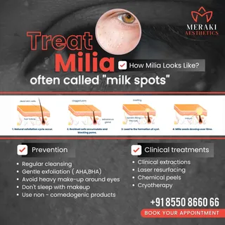 Not every tiny white bump is the same! Milia need proper diagnosis and the right treatment for safe,