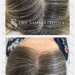 Não é shampoo. Não é polivitamínico aleatório.

É diagnóstico correto + protocolo individualizado.

