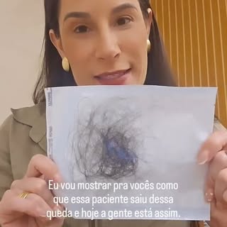 Lave seus cabelos todos os dias, isso evita descamações, oleosidade e coceira.

O couro cabeludo é u
