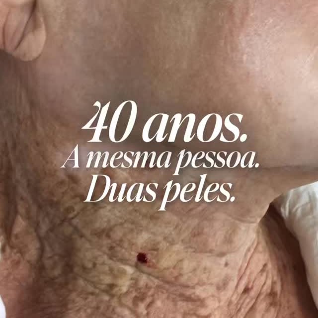 Essa imagem é frequentemente usada para ilustrar algo muito importante: o efeito cumulativo da radia