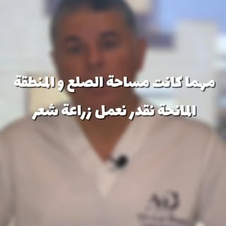 صلع كبير؟ ومنطقة مانحة صغيرة؟
 اسأل د. علاء هل في أمل للزراعة؟ 👨‍⚕️
تابع الفيديو واعرف الصح 👇
📍اح