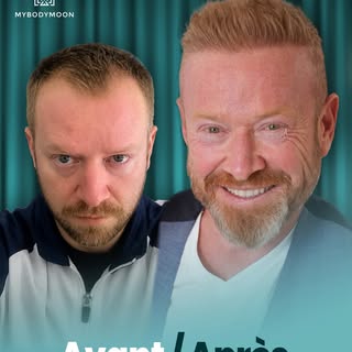 ✨ Avant ➡️ Après
Une transformation naturelle qui fait toute la différence.
Des cheveux plus denses,