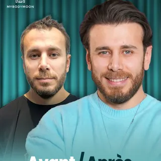 ✨ Avant ➡️ Après

Une transformation naturelle qui fait toute la différence.
Des cheveux plus denses