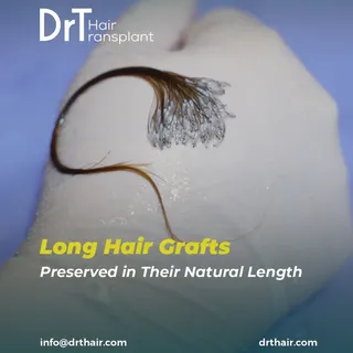 In Long Hair FUE, grafts are extracted while preserving the hair in its long form.

This allows the 