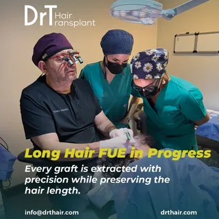 Long Hair FUE is a technique where precision can be seen in every step.

During the procedure, graft