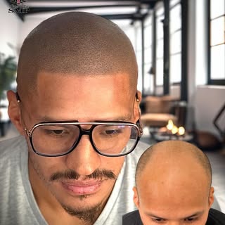 ⭐️HAIRLINE COMEBACK⭐️ Fact: A restored hairline by New Man SMP can change the whole profile. It’s al