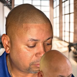 ⭐️New Man SMP⭐️ provides the most realistic and long-lasting results for hairline repair and baldnes