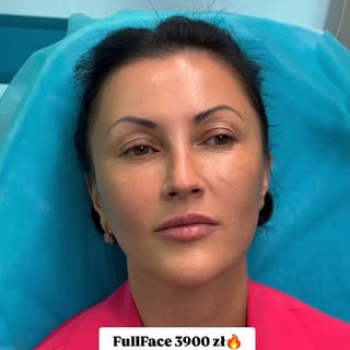 FullFace – 4 900 zł
opcja 3 900 zł przy publikacji efektów

Zakres pracy dobierany indywidualnie prz