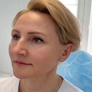 ✔ Redukcja zmarszczek (BTX)
✔ Stymulacja tkankowa
✔ Harmonizacja rysów twarzy
✔ Poprawa jakości skór