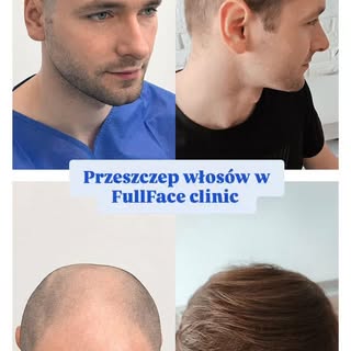 Zapraszamy na bezpłatną konsultację

Od 01.09 do 31.12.2026 otwieramy ograniczoną pulę terminów na p