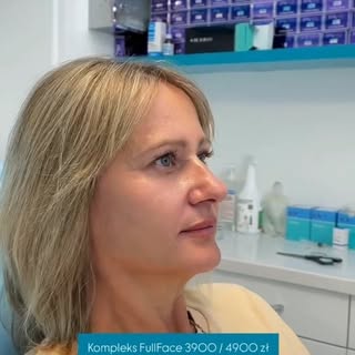 Kompleks FullFace – 4900 zł
Opcja 3900 zł – przy publikacji efektów

✔ Redukcja zmarszczek (BTX)
✔ S