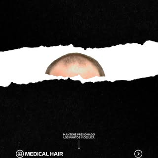 Agendá un turno y descubrí la transformación capilar que estabas buscando. ✨

#MedicalHair #CreceSie