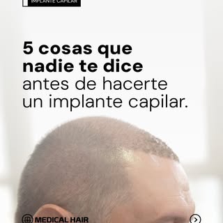 Todos te muestran el resultado final, pero casi nadie te cuenta la letra chica.

Deslizá este carrus
