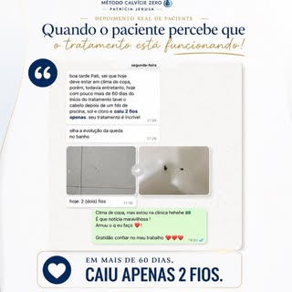 Tá usando minoxidil e n está resolvendo sua calvície?