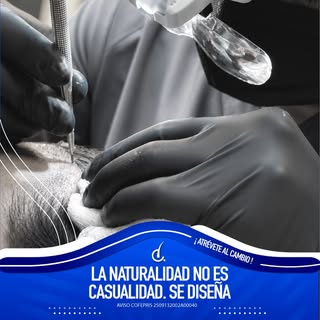✨💙 Cada procedimiento comienza con una planeación personalizada para lograr un resultado natural y 