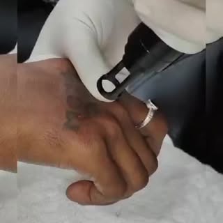 **Tattoo Removal Special Offers**

**Erase the Past, Embrace the Future!✨**

Are you looking to remo